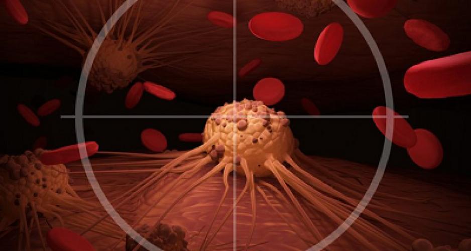 Стадії раку