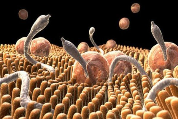 5 ознак того, що у вас є глисти